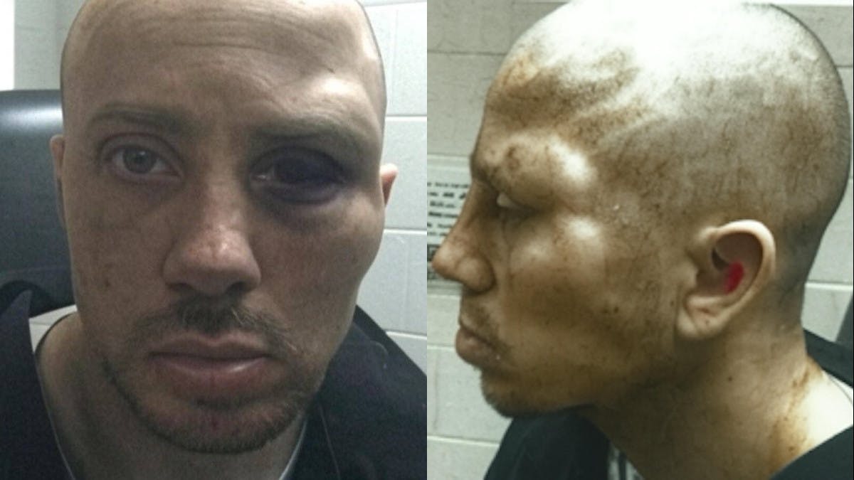 January 6 Convict Says He Was Tortured In Prison Under Biden, Seeks $17 Million From Feds